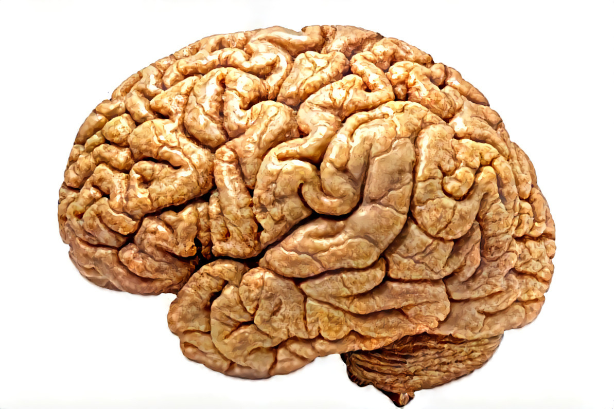 ''Walnut brain''  _ source: author not found  _ (200607)