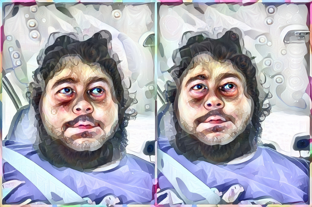 Stereogram selfie!