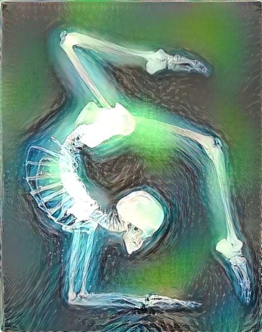 Scorpion pose on X-Ray