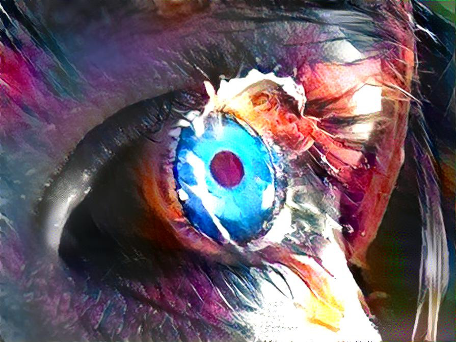  Eye