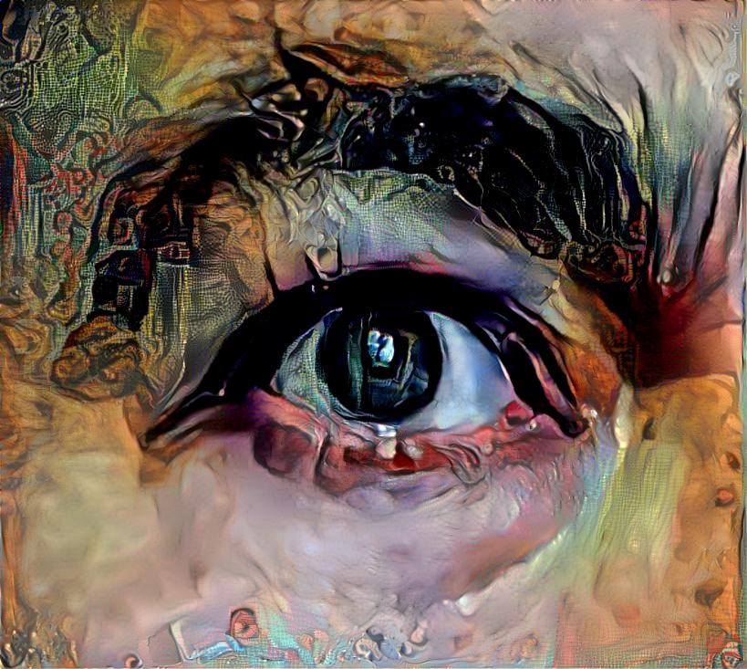 Eye