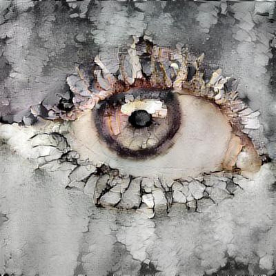 Eye