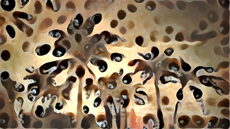 Trypophobia