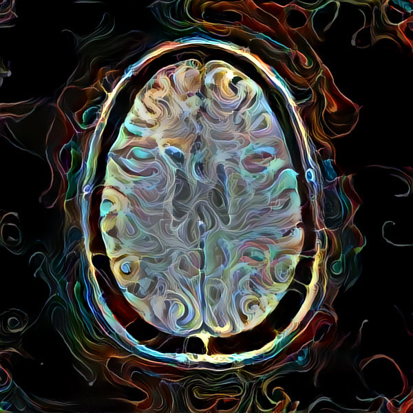 Brain on fire