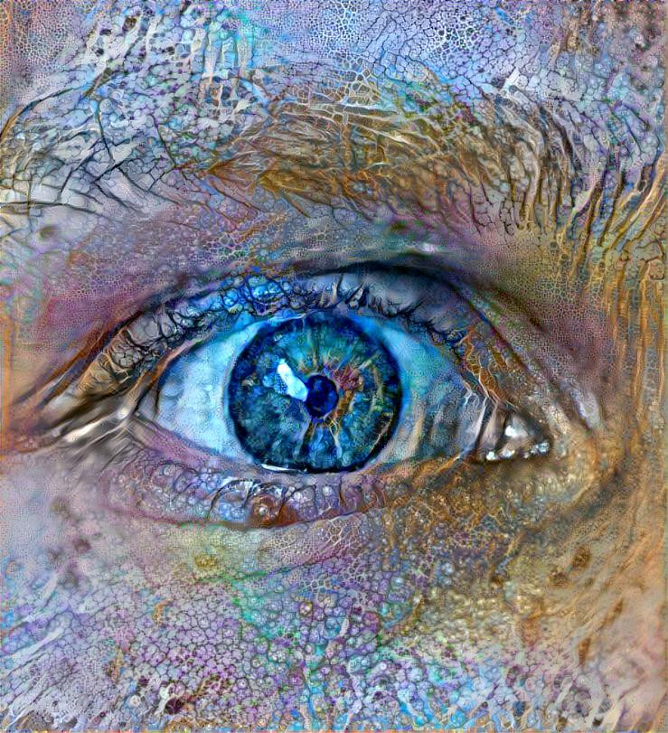 Eye